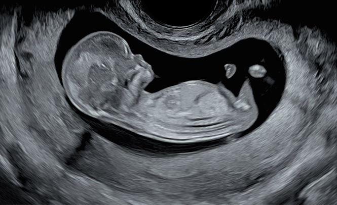 Genetic Ultrasound