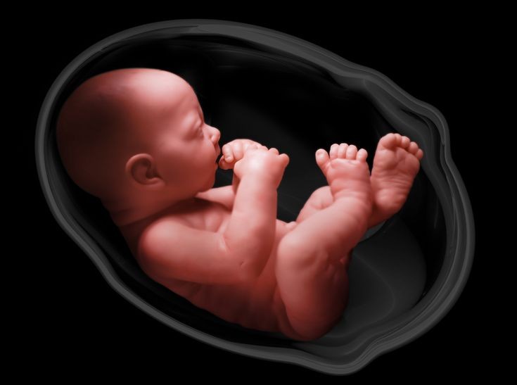 infertility in women